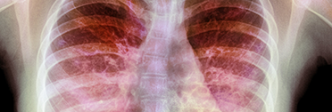 Mental Health Screening and Treatment in CF Clinics: Practical Considerations for Implementing Guideline Recommendations Mental Health Screening and Treatment in CF Clinics: Practical Considerations for Implementing Guideline Recommendations
